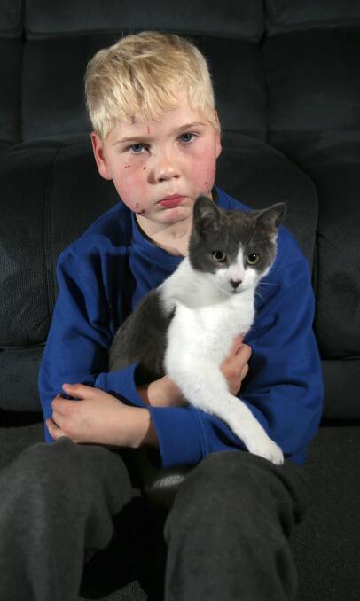 STILL SORE: Corey Moore cuddles with cat Jake. Corey's face was lacerated in a fight with another student at his school. Picture: ELENOR TEDENBORG