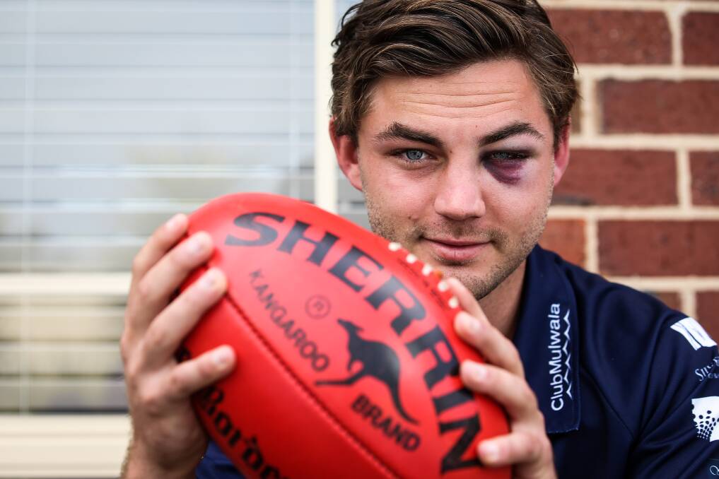 Yarrawonga's Brady Pritchard fractured his cheekbone in three places and broke his jaw following a head clash in Sunday's first semi against Lavington.
