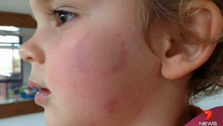 Duty of care: Creche standards are being questioned after the attack on Eva. Photo: Channel Seven