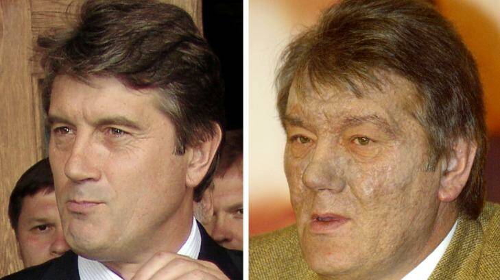 Viktor Yushchenko before and after his mysterious illness. 