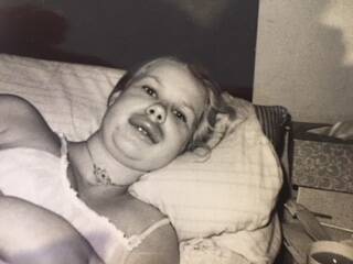 Maureen in bed after HAE caused her face lips and throat to swell, a tracheotomy in her neck.