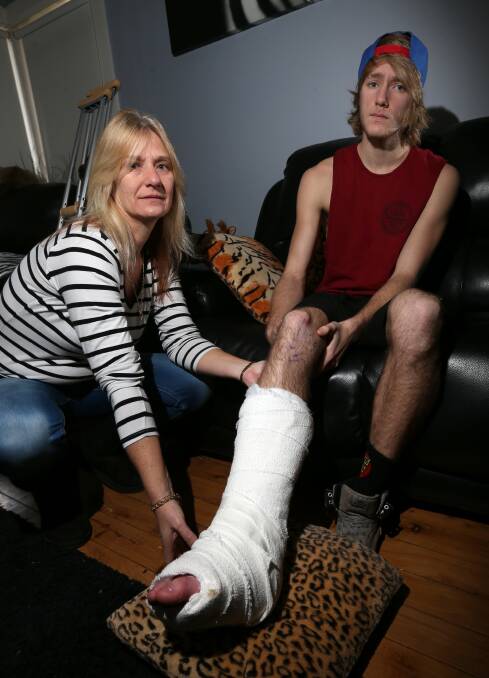 Christine Warren says her son, Blayde Kendrick, broke his leg at the Flip Out trampoline centre. Picture: PETER MERKESTEYN