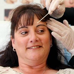 Michelle Strauss prepares for Botulinum toxin (Botox) treatment. Picture: JOHN RUSSELL