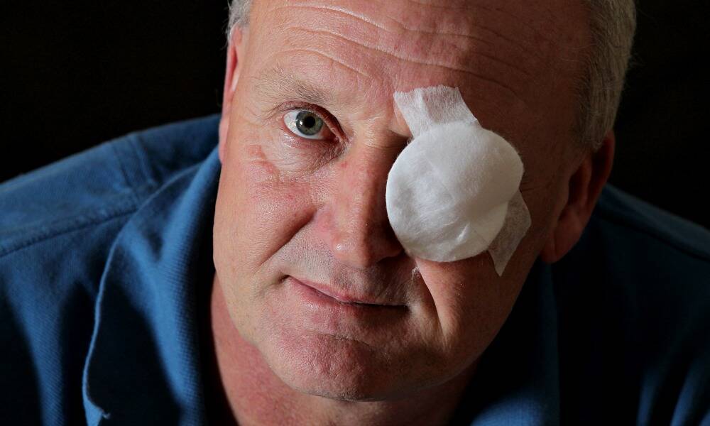 Jason James has lost sight in his left eye after being bashed in Dean St after a night out. PICTURE: David Thorpe.