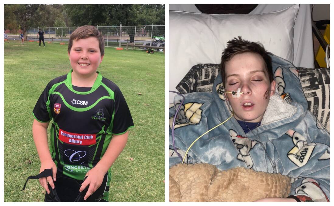Wodonga boy Jai Coomber before and after his appendix surgery in April 2021. Picture supplied