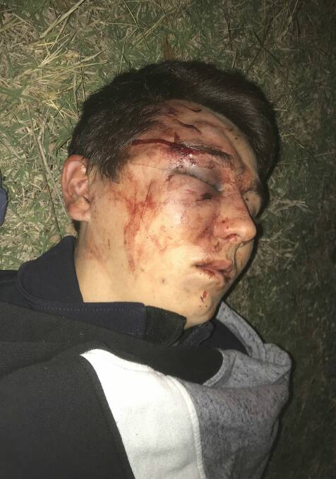 AFTERMATH: Jack Boehm was bruised and bloodied when he was found by police on the night of the road rage attack, before being taken to Wodonga hospital.