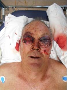 SERIOUS INJURIES: Kelvin Tennant after he was shot.