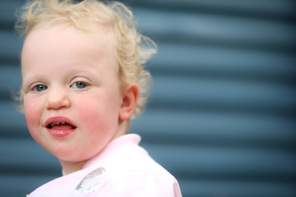 THE EYES HAVE IT: Border Mail journalist Jodie O'Sullivan's daughter, Norah, has the distinctive starburst pattern in her eyes, characteristic of Williams Syndrome.