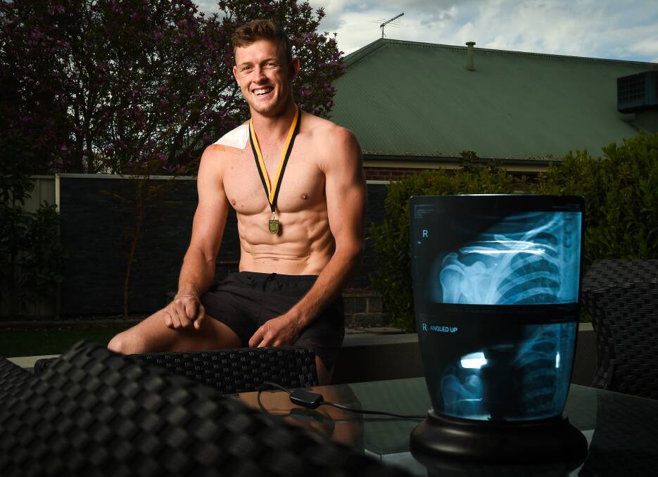 BATTLE-SCARRED: Wounded Panther Nick Meredith
with his shoulder X-rays. Picture: MARK JESSER