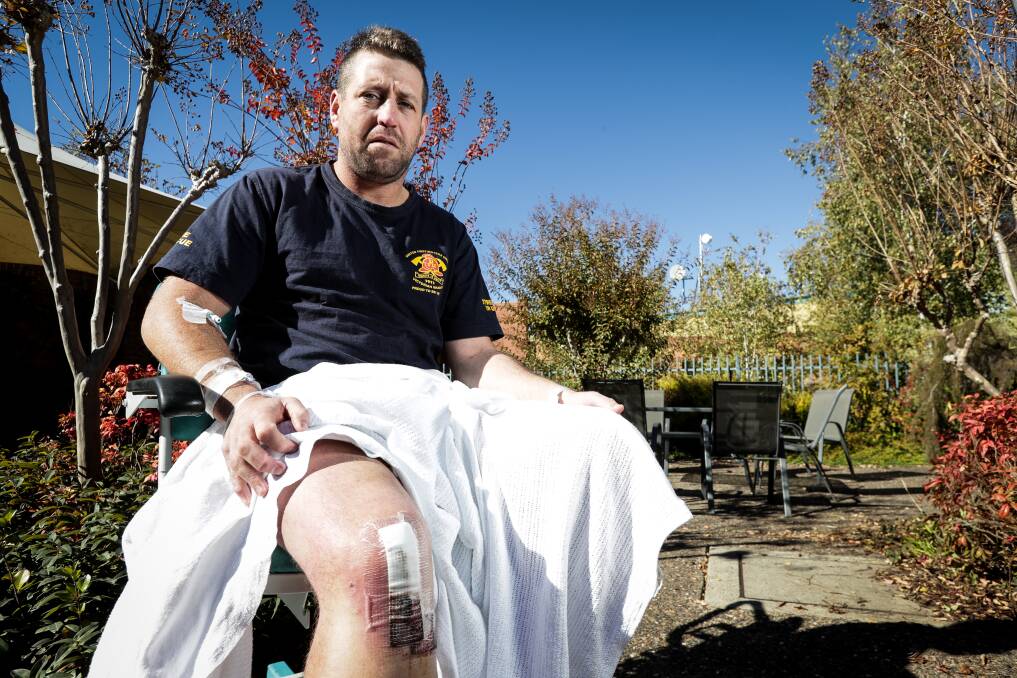 BAD BREAK: Lavington footballer Matt Pendergast faces a long recovery after breaking his leg in two places against North Albury. Picture: JAMES WILTSHIRE