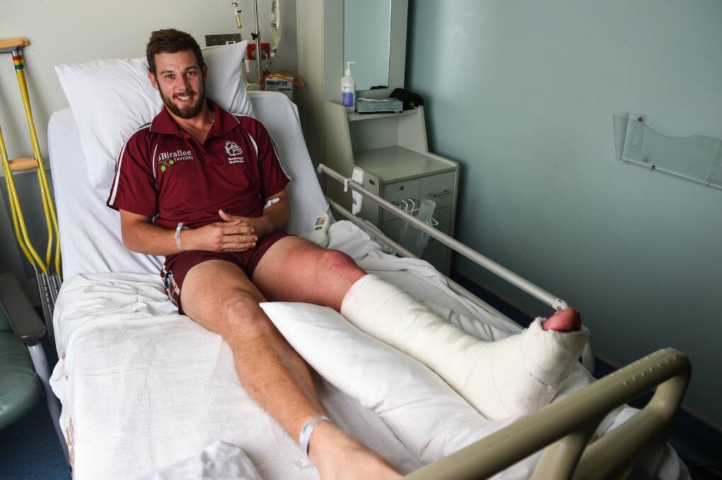 SIDELINED: Wodonga's Tom Johnson can still smile despite suffering a horror
injury against Yarrawonga on Saturday. Picture: MARK JESSER