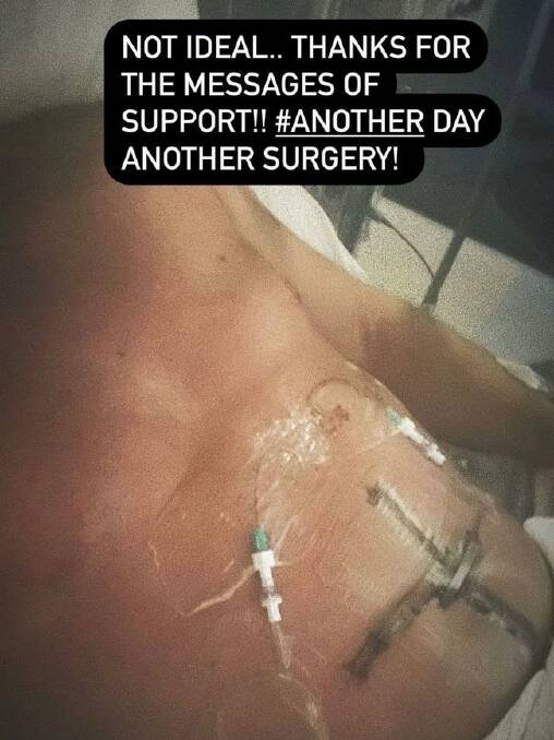 Former Geelong Footballer Steve Johnson posted a picture from the hospital showing his injuries after stabbing himself with a knife. Picture: Instagram.