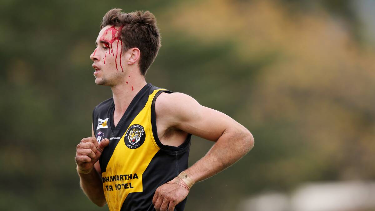 BLOOD, SWEAT AND TEARS: Josh Spence has given his all for Barnawartha over the past decade. The talented Tiger has won six best and fairests to cement his standing as one of the premier players in the competition.