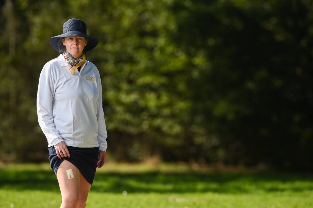 TAKE CARE: Kate O'Neill is promoting the Melanoma March message. She recently had surgery to remove a spot on her leg that had changed in colour, two and a half years after a stage one melanoma was removed. Picture: MARK JESSER