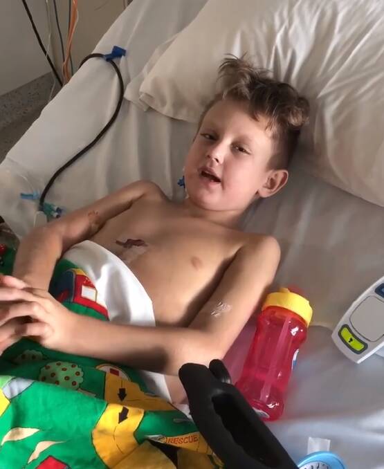 Wodonga boy Archer Irwin is recovering in hospital after receiving a liver transplant. He said 'thank you' in a video message on Facebook.