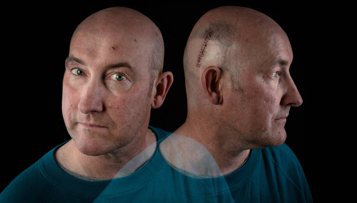 A double exposure and some precise lighting made the photo of Steven Johnson, of Rosewhite, who has brain cancer, more than just a simple portrait. 