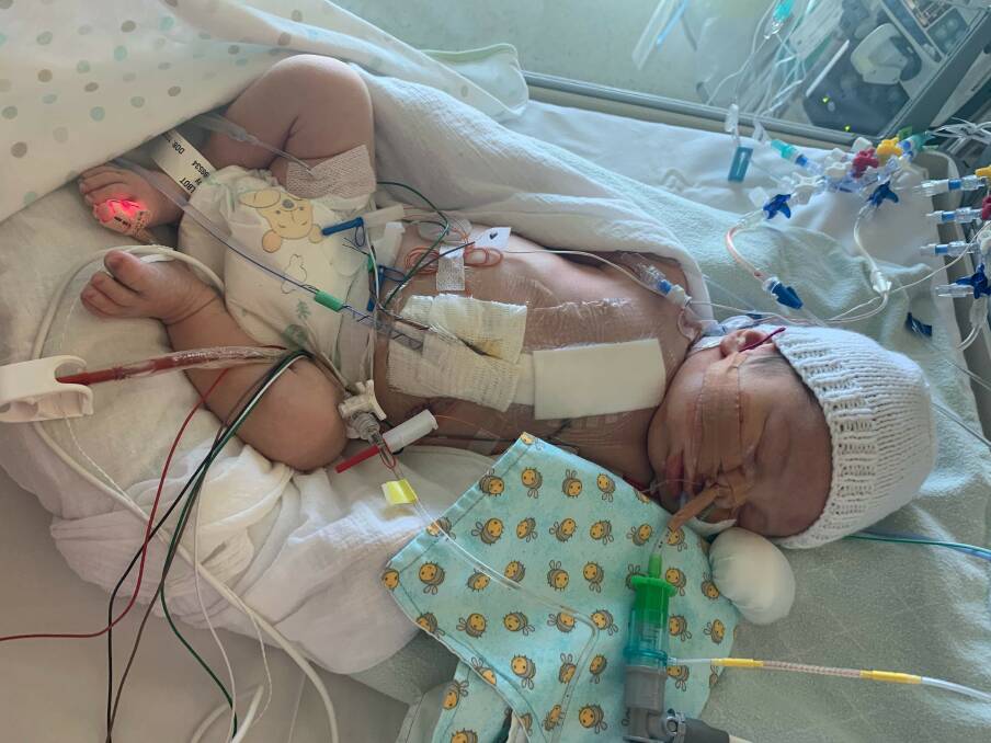 LITTLE BATTLER: Ollie Talbot after his open heart surgery at the Royal Children's Hospital. Picture: ABBY TALBOT