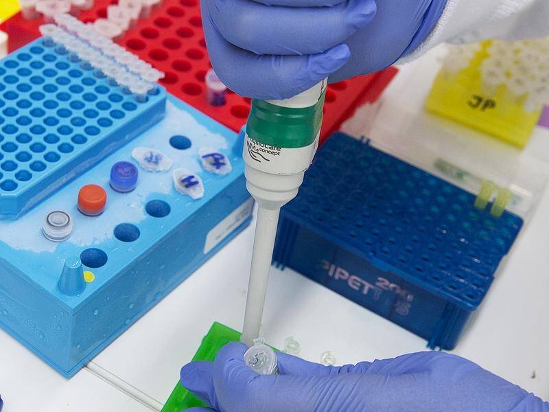 Pre-clinical tests are under way for the University of Queensland's COVID-19 vaccine.