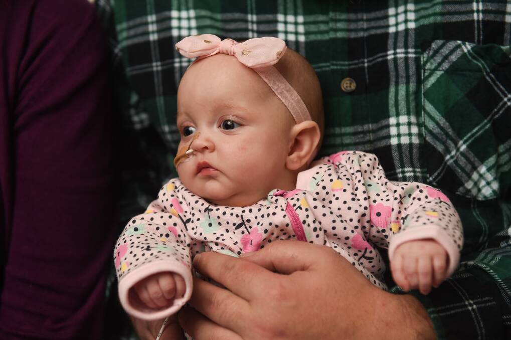 Born with a one in 50,000 condition, little Charlotte faces big challenges