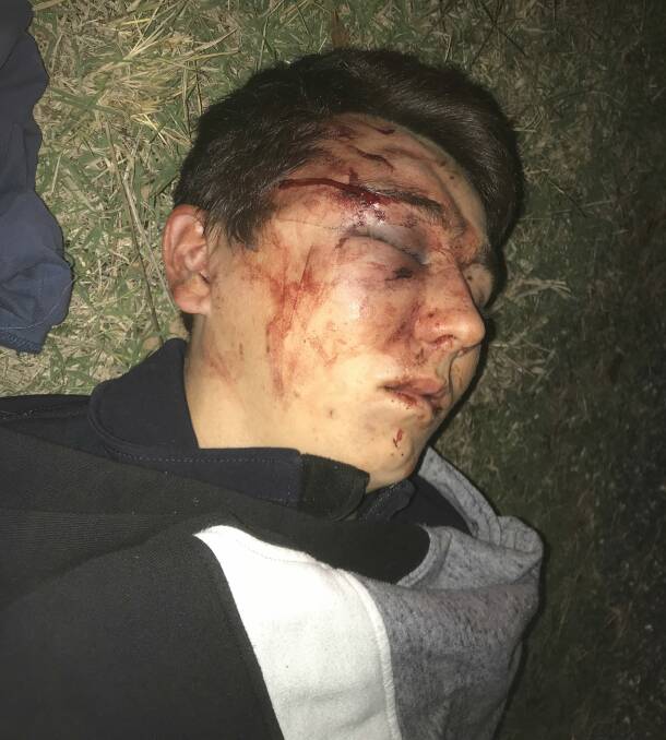 INJURED: Police took this image of Jack Boehm after he was attacked. He said he feared for his life during the ordeal. 