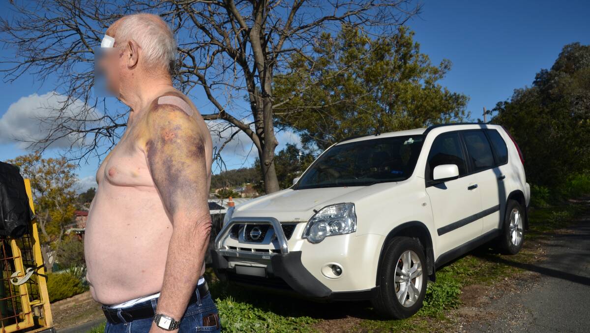 BRUISED: The man was hit with a hammer and tomahawk while in bed as the two intruders tried to steal his Nissan X-Trail. 