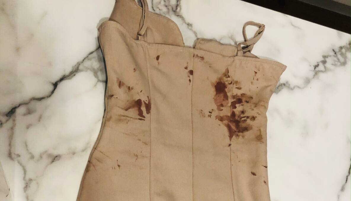 BLOODIED: Her dress following an incident. 