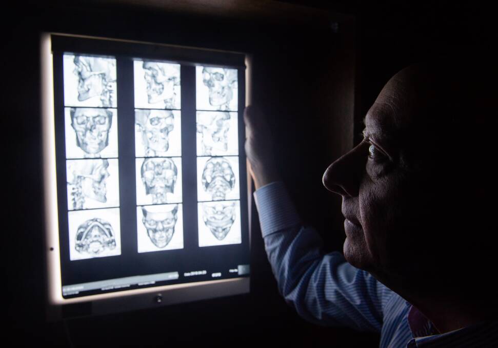 Dr John Hennessy, who operated on Xavier Mardling in 2006, inspects a patient's images. Picture: MARK JESSER