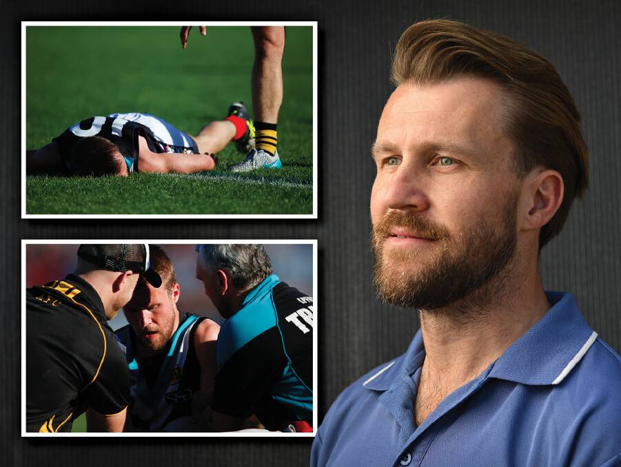 Former Lavington footballer Mitch Palmer suffered at least 20 concussions during his football career. File pictures