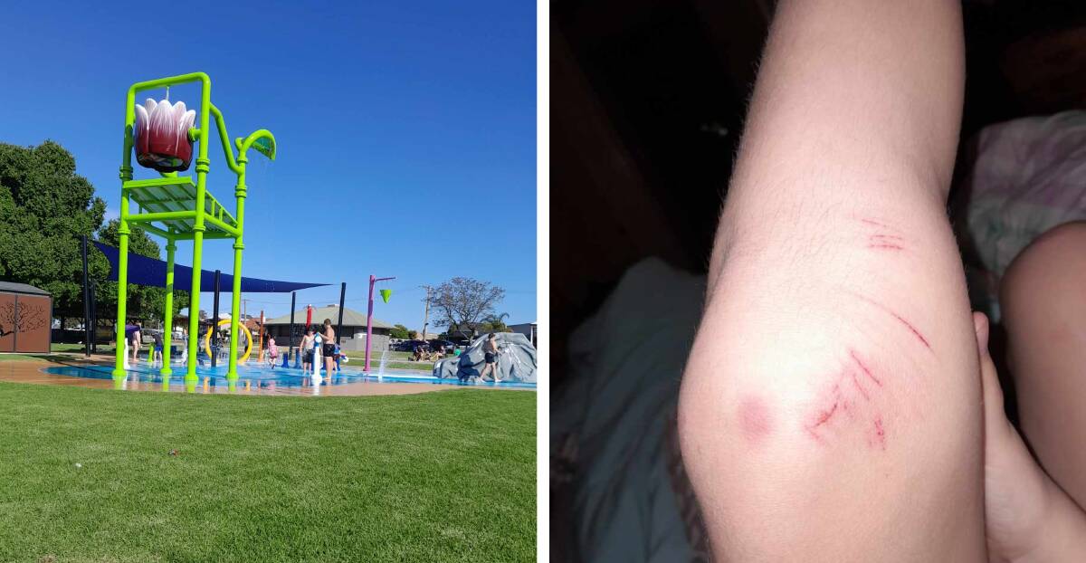 Leisa Hodgson's daughter suffered bruising and scratches after falling over at the Yarrawonga Splash Park on Friday afternoon. Picture supplied